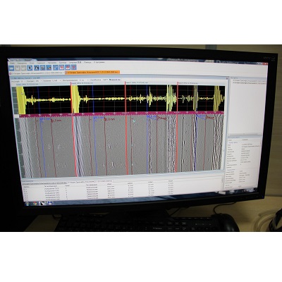 Установка для механизированного ультразвукового контроля MSCAN-SUPOR